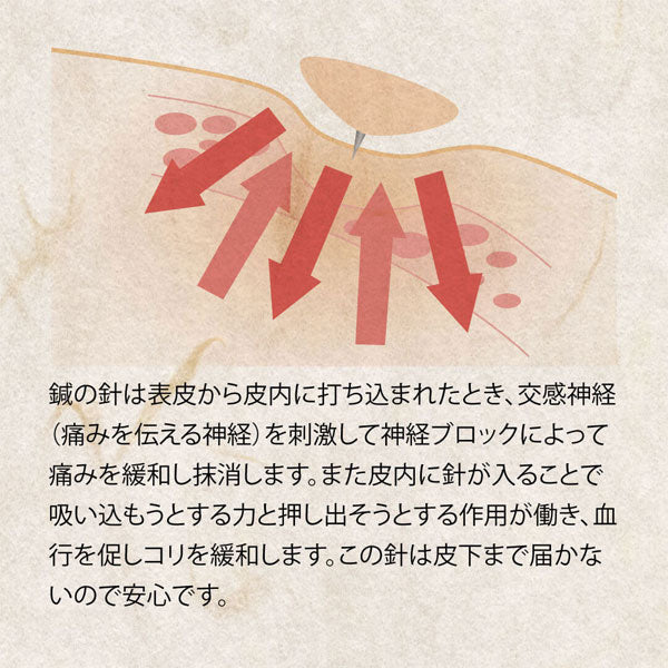 【ネコポス送料無料】アクティバイタルActivital解脱鍼NHY1000